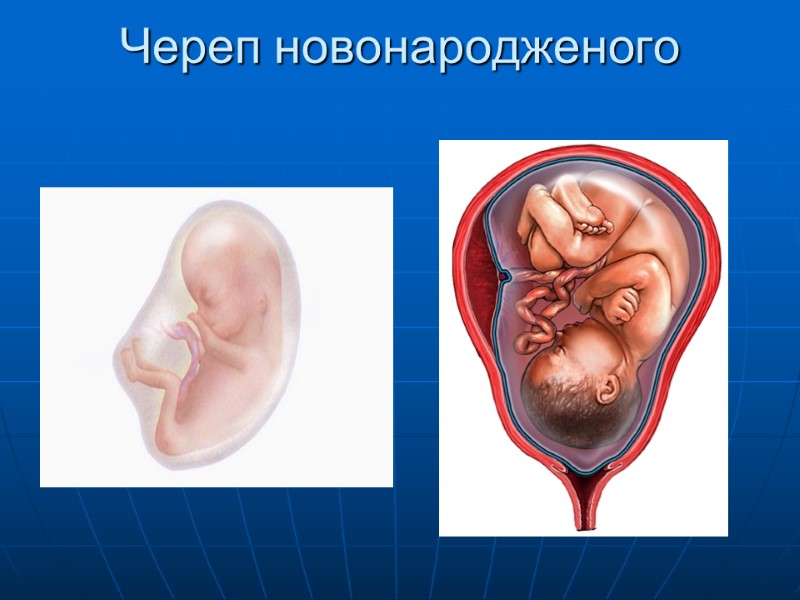 Череп новонародженого